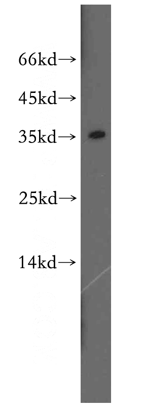 A549 cells were subjected to SDS PAGE followed by western blot with Catalog No:115826(SULT1A3 antibody) at dilution of 1:200