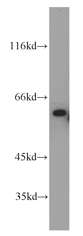 PC-3 cells were subjected to SDS PAGE followed by western blot with Catalog No:112679(MAP3K11 antibody) at dilution of 1:200