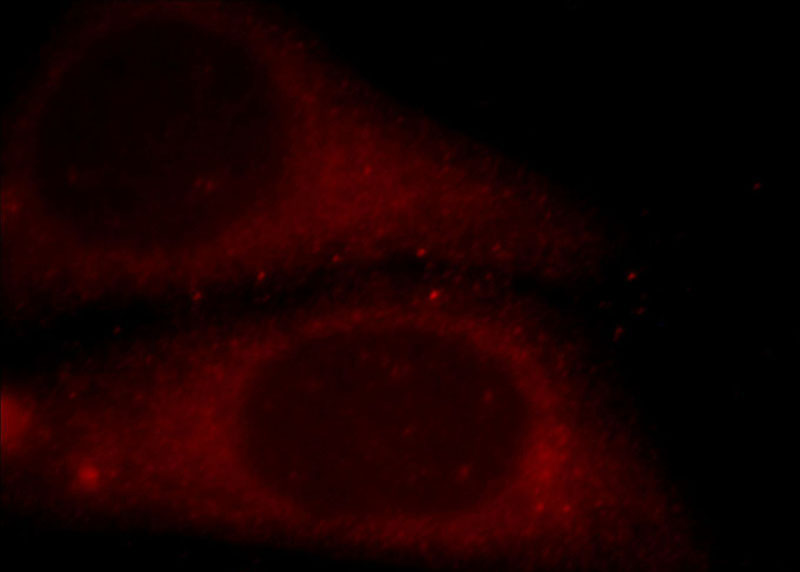 Immunofluorescent analysis of HepG2 cells, using EFS antibody Catalog No:110211 at 1:25 dilution and Rhodamine-labeled goat anti-rabbit IgG (red).