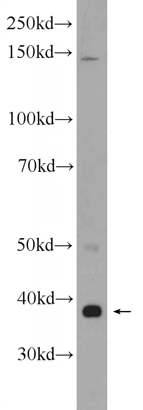 SH-SY5Y cells were subjected to SDS PAGE followed by western blot with Catalog No:117036(ZDHHC9 Antibody) at dilution of 1:300