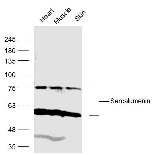 Fig1: Sample:; Heart (Mouse) Lysate at 40 ug; Muscle (Mouse) Lysate at 40 ug; Skin (Mouse) Lysate at 40 ug; Primary: Anti- Sarcalumenin at 1/300 dilution; Secondary: IRDye800CW Goat Anti-Rabbit IgG at 1/20000 dilution; Predicted band size: 97kD; Observed band size: 75 kD