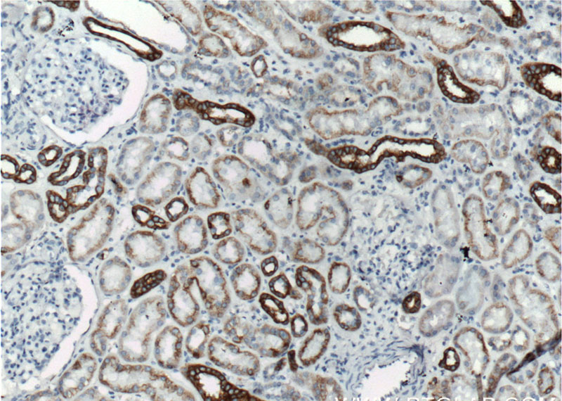 Immunohistochemistry of paraffin-embedded human kidney tissue slide using Catalog No:107231(KRT18 Antibody) at dilution of 1:1200 (under 10x lens). Heat mediated antigen retrieved with Citric acid buffer, pH6.0