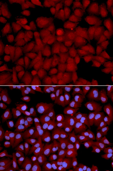 Immunofluorescence - PPP1CB Polyclonal Antibody 