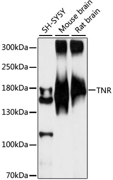 Western blot - TNR Polyclonal Antibody 