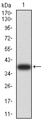 Fig1: Western blot analysis of Rab6b on human Rab6b recombinant protein using anti-Rab6b antibody at 1/1,000 dilution.