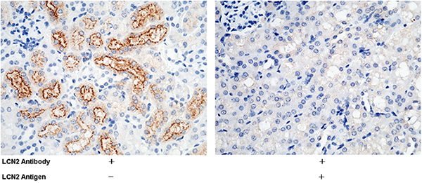 LCN2 / NGAL Antibody, Rabbit PAb, Antigen Affinity Purified, Immunohistochemistry
