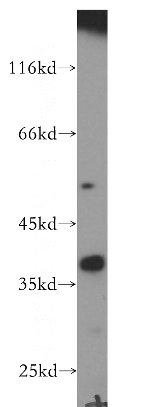 human adrenal gland tissue were subjected to SDS PAGE followed by western blot with Catalog No:109677(CYLC2 antibody) at dilution of 1:600