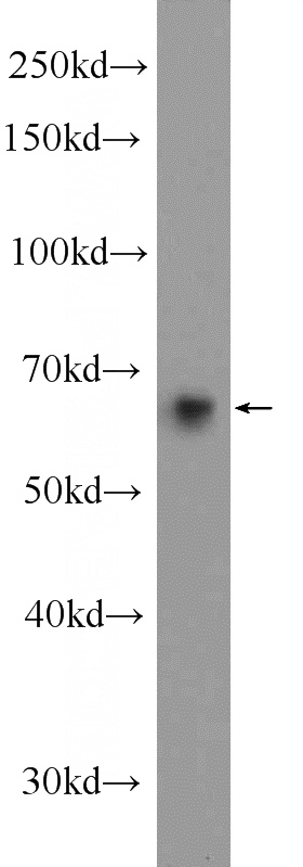 mouse brain tissue were subjected to SDS PAGE followed by western blot with Catalog No:110225(EHD3 Antibody) at dilution of 1:300