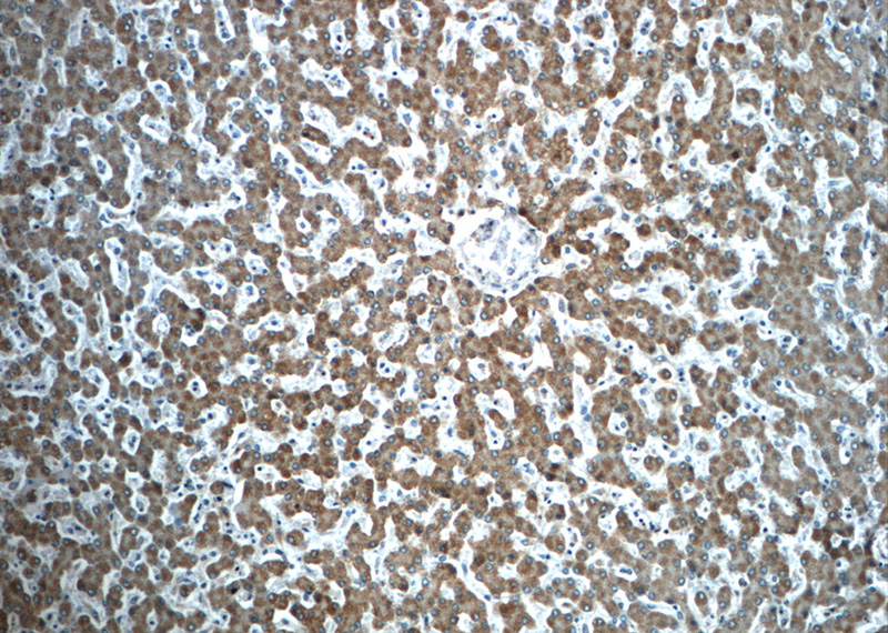 Immunohistochemistry of paraffin-embedded human liver slide using Catalog No:116385(TTC39B Antibody) at dilution of 1:50 (under 10x lens)