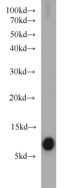 HeLa cells were subjected to SDS PAGE followed by western blot with Catalog No:114961(S100A4 antibody) at dilution of 1:500