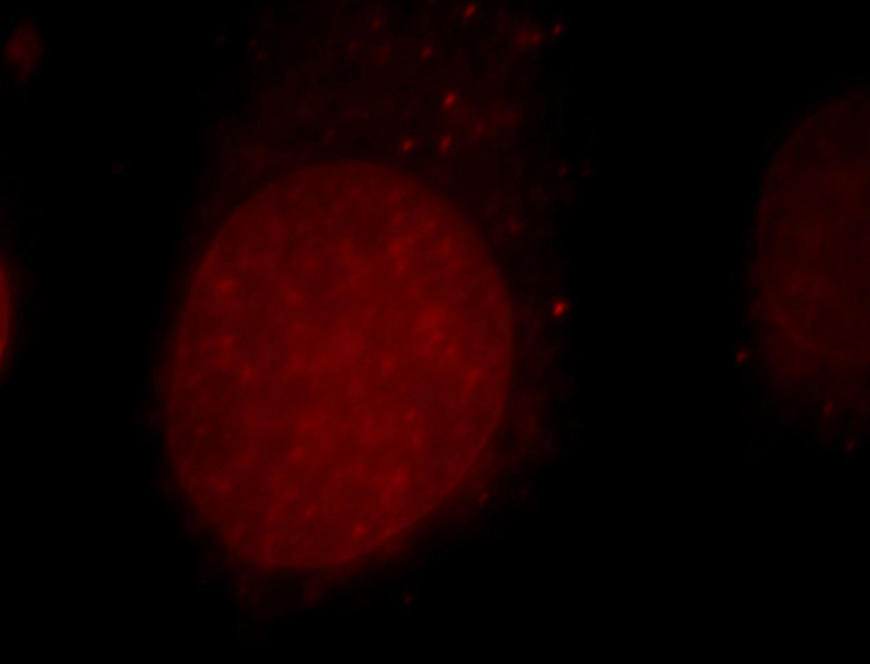 Immunofluorescent analysis of Hela cells, using CUL4B antibody Catalog No:109747 at 1:25 dilution and Rhodamine-labeled goat anti-rabbit IgG (red).