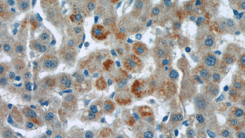 Immunohistochemistry of paraffin-embedded human liver tissue slide using Catalog No:115646(Sprr2i Antibody) at dilution of 1:50 (under 40x lens)