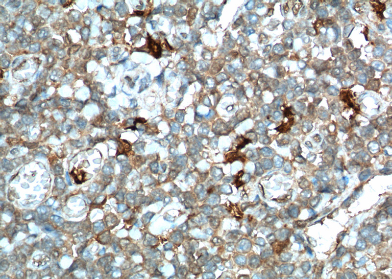 Immunohistochemistry of paraffin-embedded human tonsillitis tissue slide using Catalog No:111610(IDO1 Antibody) at dilution of 1:100 (under 40x lens). heat mediated antigen retrieved with Tris-EDTA buffer(pH9).
