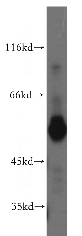 human placenta tissue were subjected to SDS PAGE followed by western blot with Catalog No:115626(ST3GAL6 antibody) at dilution of 1:200