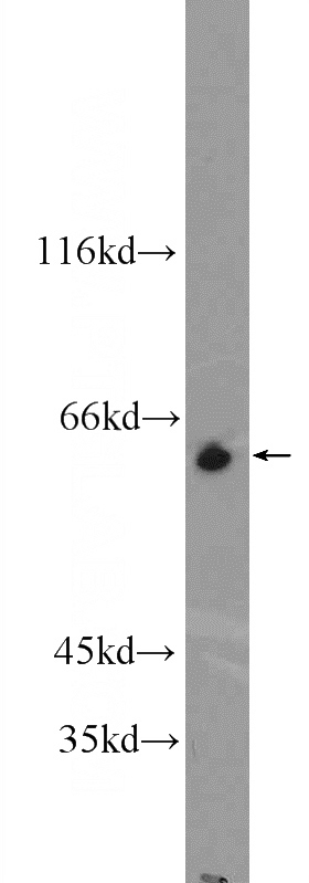 MCF-7 cells were subjected to SDS PAGE followed by western blot with Catalog No:117005(ZNF571 Antibody) at dilution of 1:300