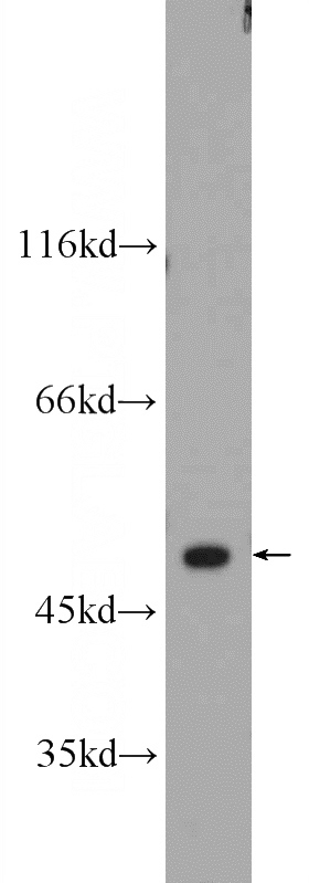 mouse kidney tissue were subjected to SDS PAGE followed by western blot with Catalog No:115224(SETD7 Antibody) at dilution of 1:1000