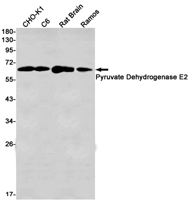 Western blot detection of Pyruvate Dehydrogenase E2 in CHO-K1,C6,Rat Brain,Ramos cell lysates using Pyruvate Dehydrogenase E2 Rabbit mAb(1:1000 diluted).Predicted band size:69kDa.Observed band size:69kDa.