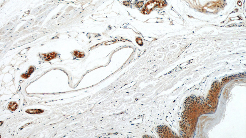 Immunohistochemical of paraffin-embedded human skin using Catalog No:107518(S100A11 antibody) at dilution of 1:50 (under 10x lens)