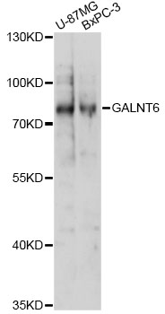 Western blot - GALNT6 Polyclonal Antibody 