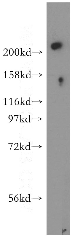 mouse lung tissue were subjected to SDS PAGE followed by western blot with Catalog No:116601(USP24 antibody) at dilution of 1:300