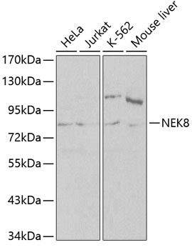 Western blot - NEK8 Polyclonal Antibody 