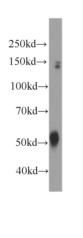 human brain tissue were subjected to SDS PAGE followed by western blot with Catalog No:107243(dynactin-2 antibody) at dilution of 1:500