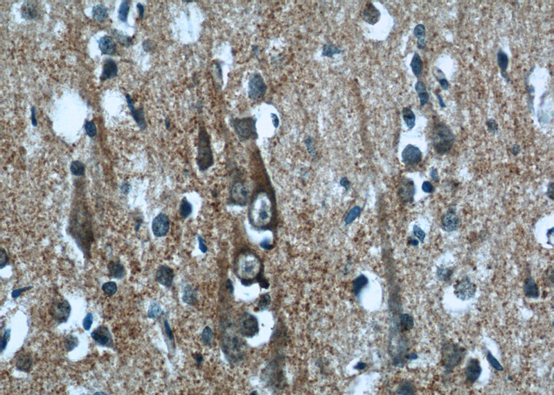 Immunohistochemistry of paraffin-embedded human brain tissue slide using Catalog No:112094(KLHL15 Antibody) at dilution of 1:50 (under 40x lens)