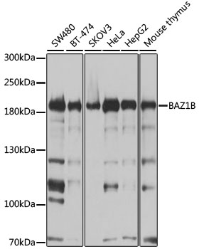 Western blot - BAZ1B Polyclonal Antibody 