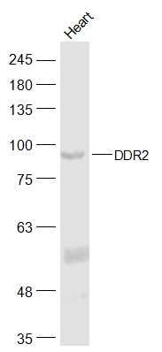 Fig3: Sample:; Heart (Mouse) Lysate at 40 ug; Primary: Anti-DDR2 at 1/300 dilution; Secondary: IRDye800CW Goat Anti-Rabbit IgG at 1/20000 dilution; Predicted band size: 92 kD; Observed band size: 92 kD