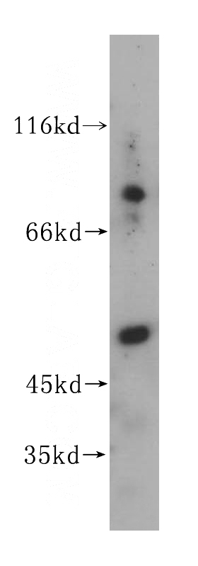 human liver tissue were subjected to SDS PAGE followed by western blot with Catalog No:110845(GALNS antibody) at dilution of 1:400