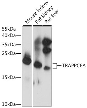 Western blot - TRAPPC6A Polyclonal Antibody 