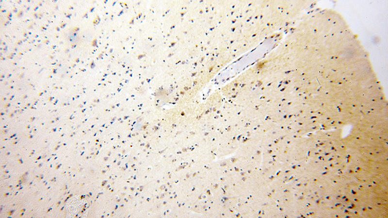 Immunohistochemical of paraffin-embedded human brain using Catalog No:112610(MICAL2 antibody) at dilution of 1:100 (under 10x lens)