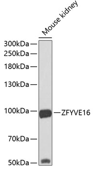 Western blot - ZFYVE16 Polyclonal Antibody 
