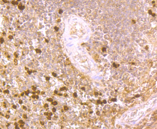 Fig7: Immunohistochemical analysis of paraffin-embedded human spleen tissue using anti-PRTN3 antibody. Counter stained with hematoxylin.