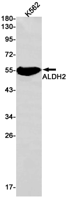 Western blot detection of ALDH2 in K562 cell lysates using ALDH2 Rabbit pAb(1:1000 diluted).Predicted band size:56kDa.Observed band size:56kDa.