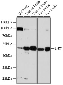 Western blot - LHX1 Polyclonal Antibody 
