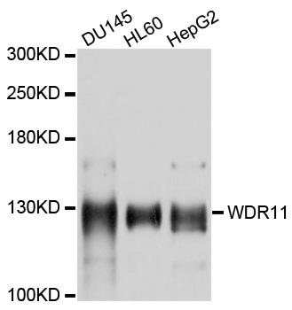 Western blot - WDR11 Polyclonal Antibody 