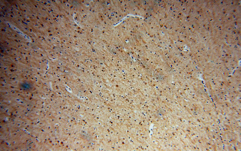 Immunohistochemical of paraffin-embedded human brain using Catalog No:112570(MDM1 antibody) at dilution of 1:100 (under 10x lens)