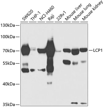 Western blot - LCP1 Polyclonal Antibody 