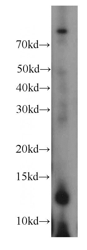 PC-3 cells were subjected to SDS PAGE followed by western blot with Catalog No:110469(FAM127B antibody) at dilution of 1:500