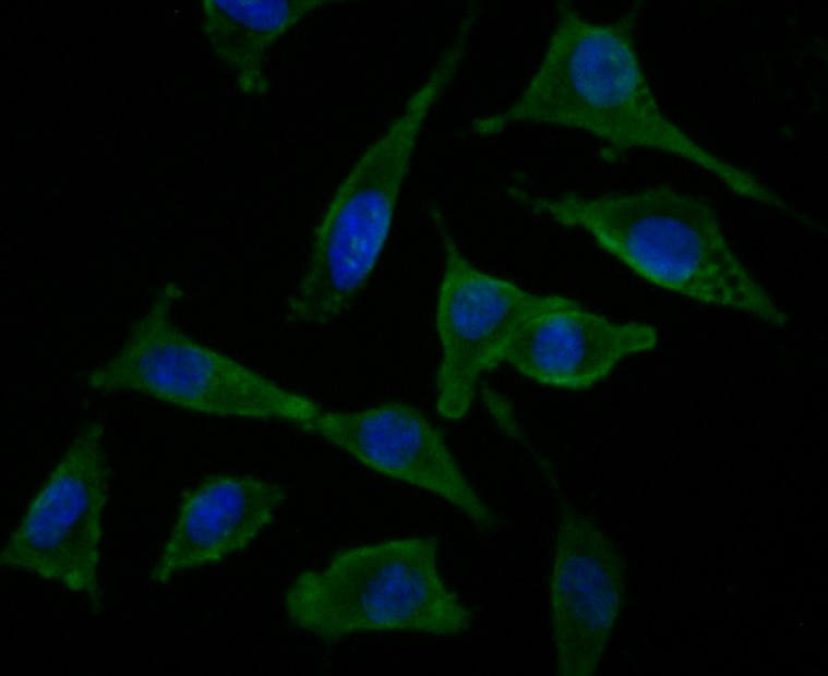 Fig3: ICC staining NRCAM in SH-SY5Y cells (green). The nuclear counter stain is DAPI (blue). Cells were fixed in paraformaldehyde, permeabilised with 0.25% Triton X100/PBS.
