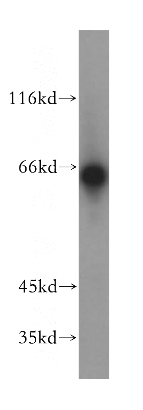 mouse heart tissue were subjected to SDS PAGE followed by western blot with Catalog No:112207(LGI2 antibody) at dilution of 1:800