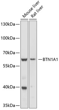 Western blot - BTN1A1 Polyclonal Antibody 