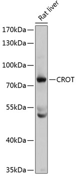 Western blot - CROT Polyclonal Antibody 