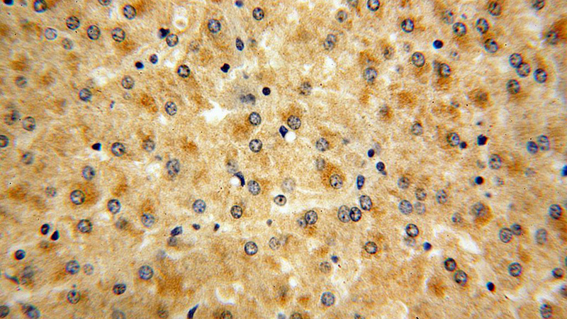 Immunohistochemical of paraffin-embedded human liver using Catalog No:113564(PALMD antibody) at dilution of 1:100 (under 40x lens)