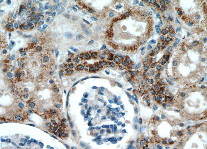 Immunohistochemical of paraffin-embedded human kidney using Catalog No:112035(GLS antibody) at dilution of 1:100 (under 40x lens)