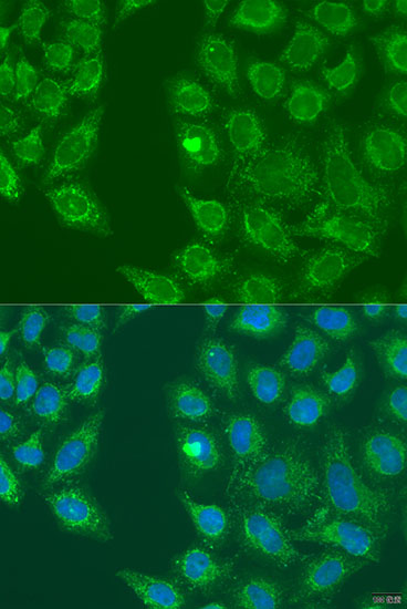 Immunofluorescence - HSD17B3 Polyclonal Antibody 