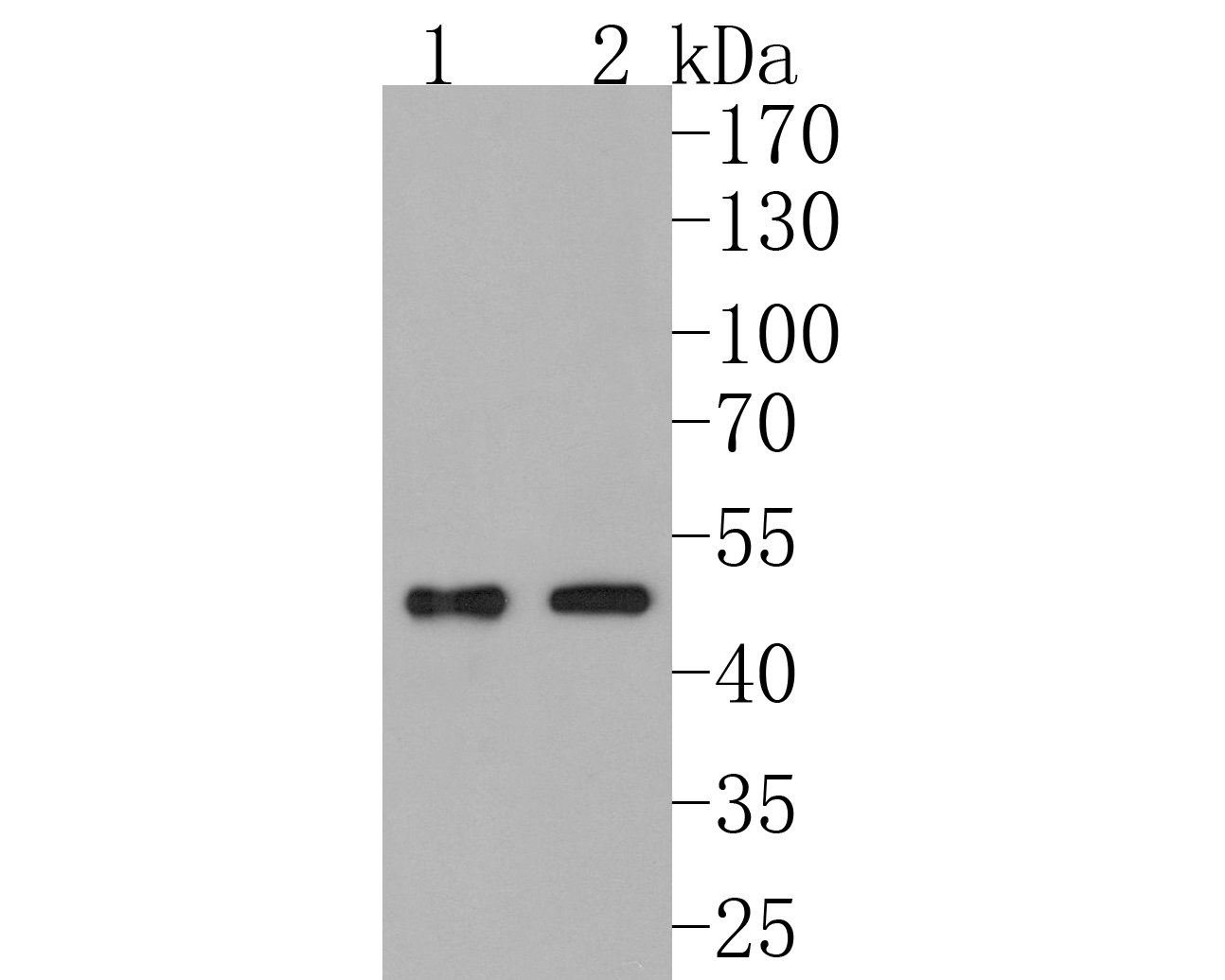 Fig1:; Western blot analysis of PDK1 on different lysates. Proteins were transferred to a PVDF membrane and blocked with 5% BSA in PBS for 1 hour at room temperature. The primary antibody ( 1/500) was used in 5% BSA at room temperature for 2 hours. Goat Anti-Rabbit IgG - HRP Secondary Antibody (HA1001) at 1:200,000 dilution was used for 1 hour at room temperature.; Positive control:; Positive control:; Lane 1: Rat heart tissue lysate; Lane 2: Mouse heart tissue lysate