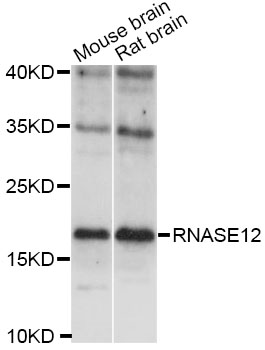 Western blot - RNASE12 Polyclonal Antibody 