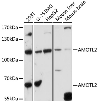Western blot - AMOTL2 Polyclonal Antibody 